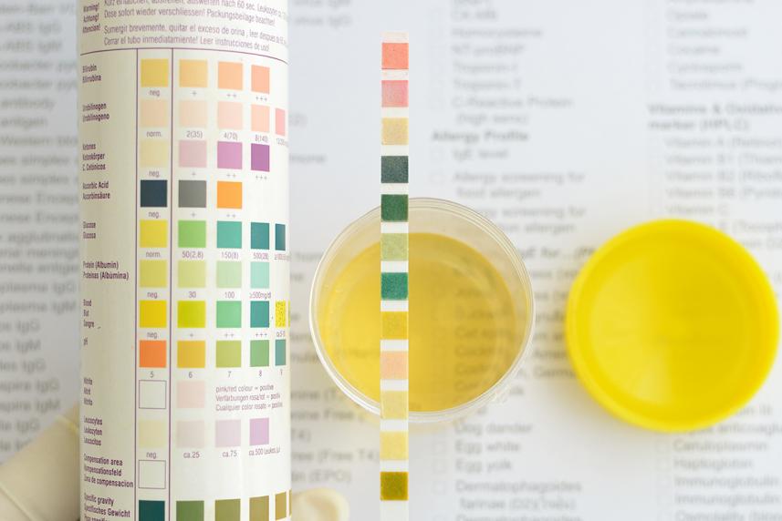 Image of kidney function test